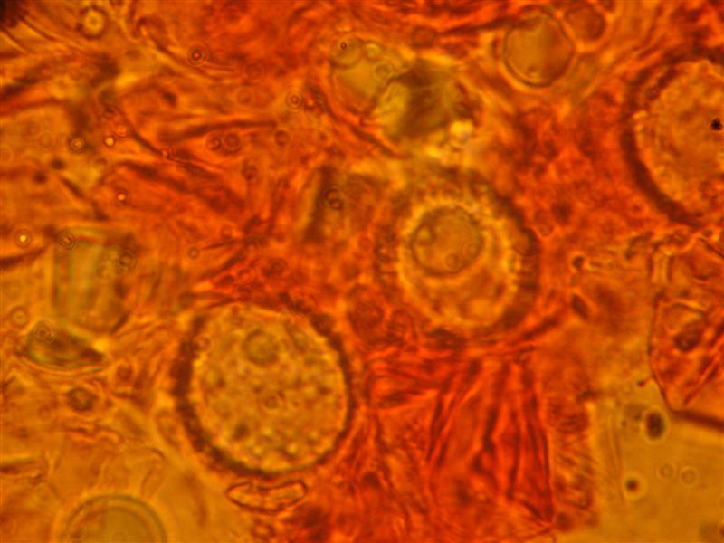 Altra Scutellinia da determinare